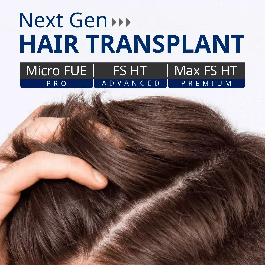 Hair-Transplant-Clinic-Bangalore-M