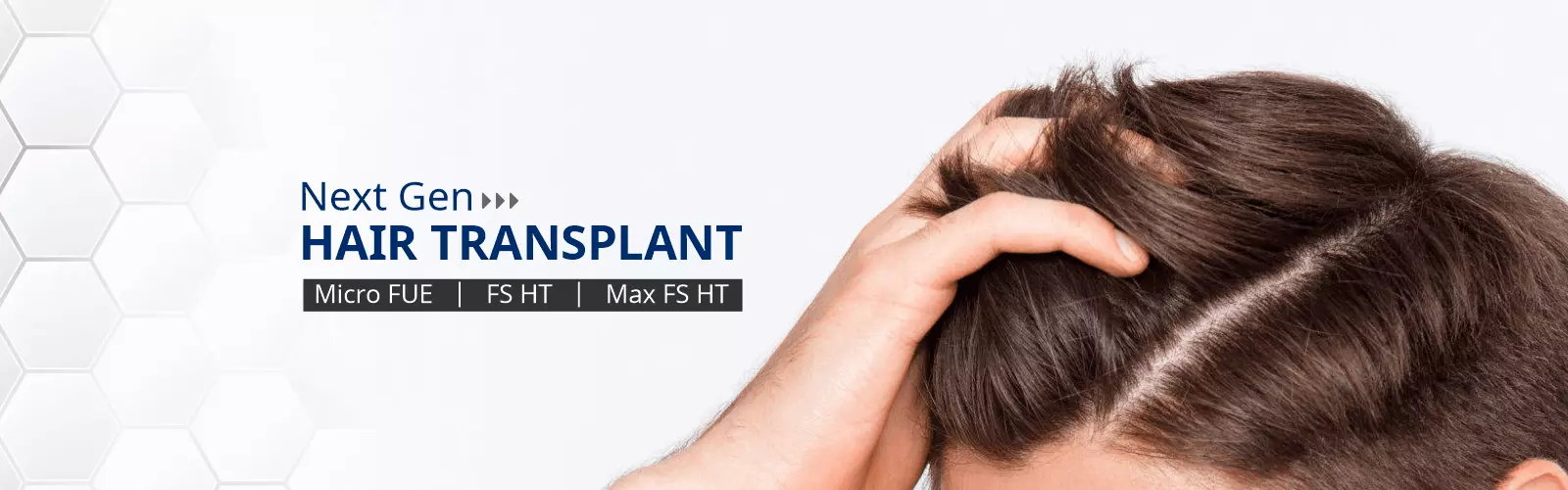 Hair-Transplant-Clinic-Bangalore-S