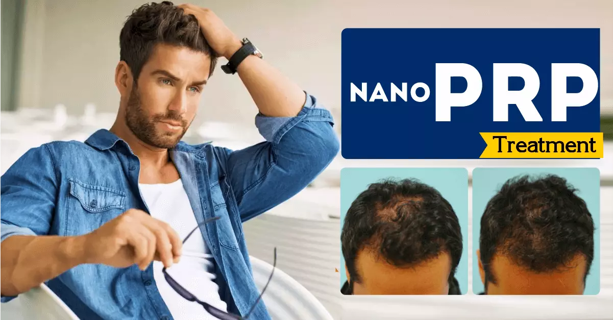 PRP-Hair-Care-Treatment-Bangalore