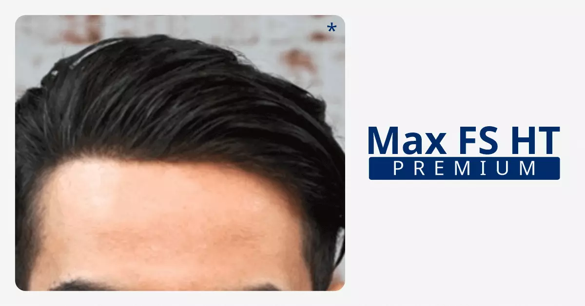 Hair-transplant-Bangalore