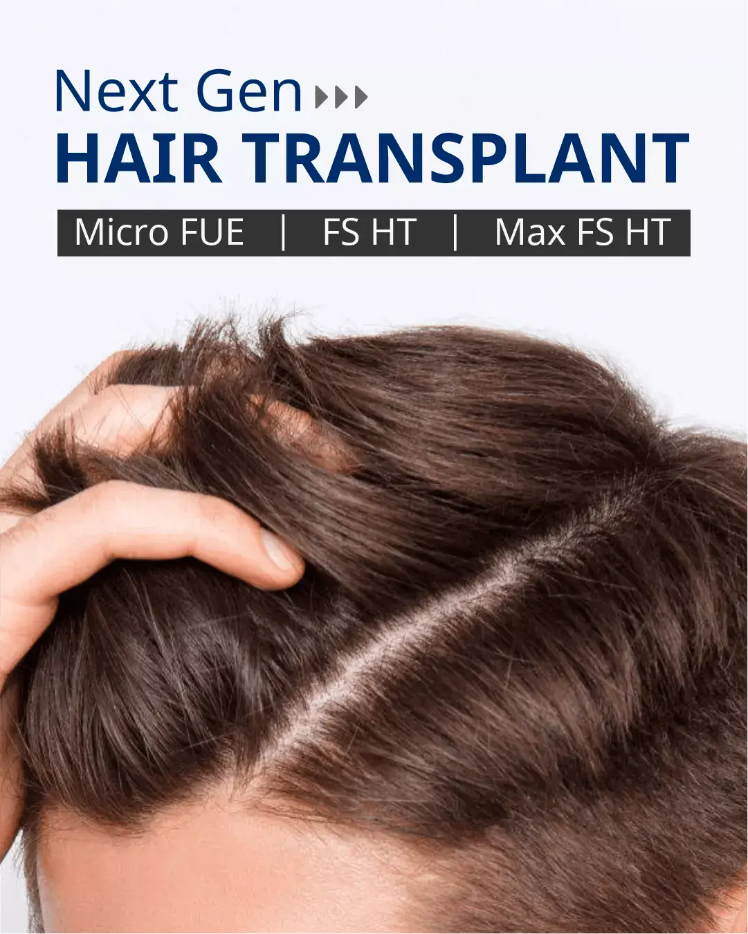 Follilife - Hair Transplant Clinic Bangalore